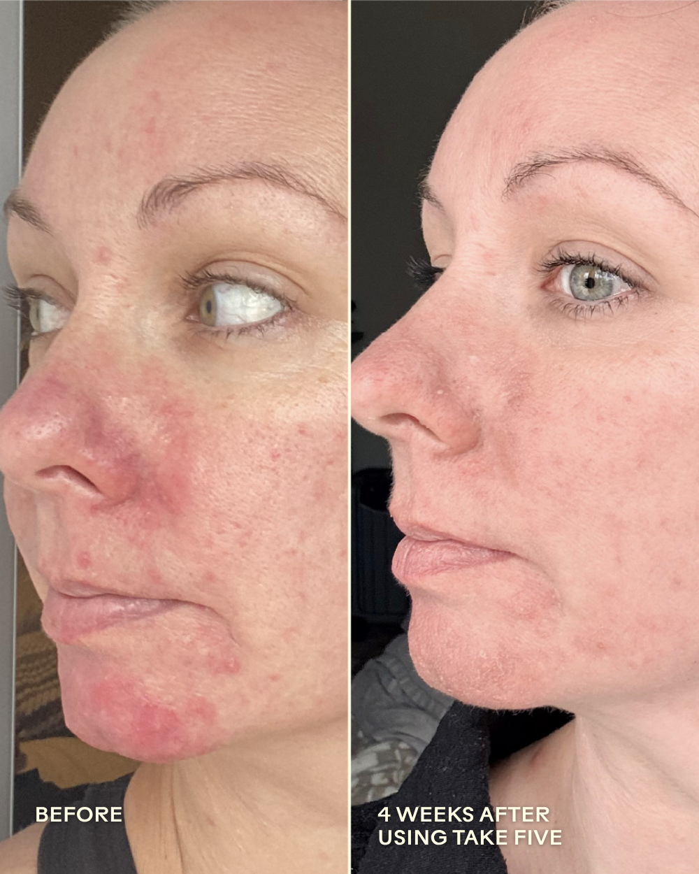 Take Five™ Hypochlorous Acid Balancing Body + Face Spray