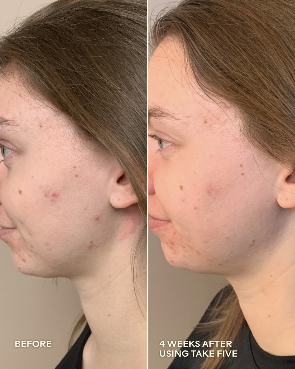 Take Five™ Hypochlorous Acid Balancing Body + Face Spray