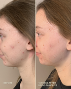 Take Five™ Hypochlorous Acid Balancing Body + Face Spray