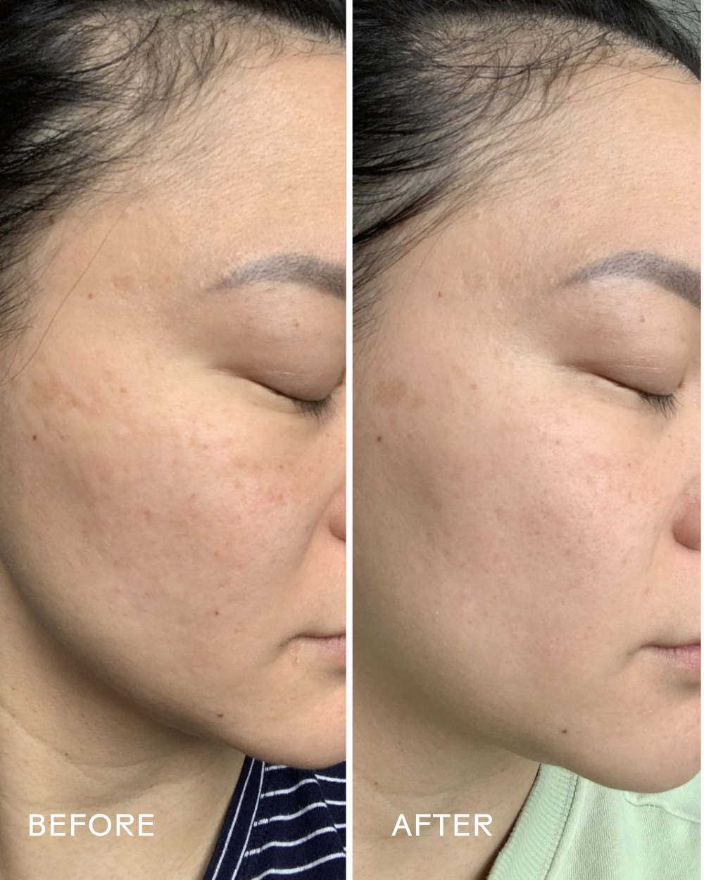 Jelly Drops Kakadu Plum + Mushroom Hyaluronic Acid Serum